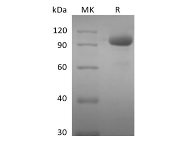 Recombinant Human EPHA8 (C-Fc)