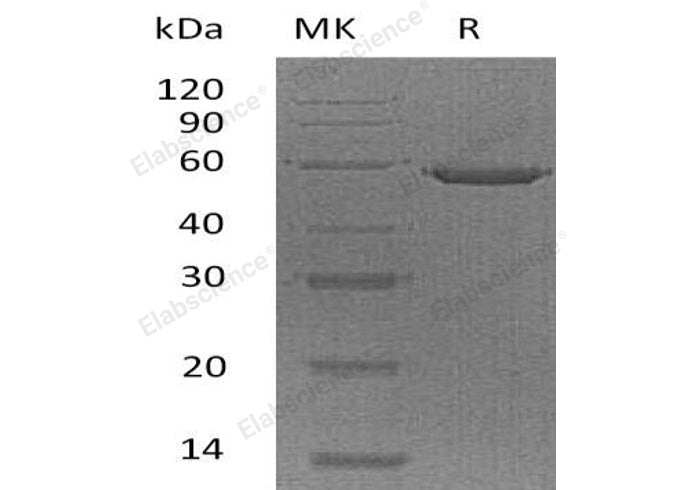Recombinant Human Ephrin-A5/EFNA5 Protein (Fc Tag)