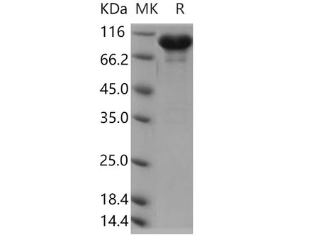 Recombinant Human ERP72/PDIA4 Protein (Fc Tag)