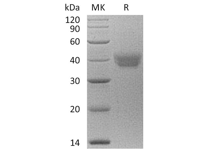 Recombinant Human ESAM Protein (aa 30-247, His Tag)