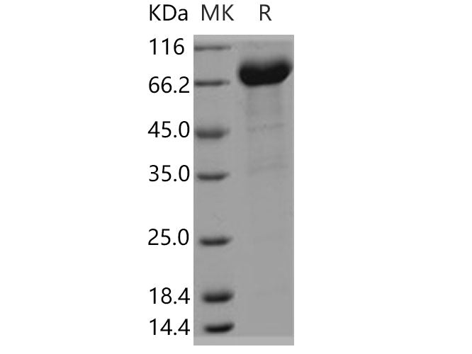 Recombinant Human FAM171B/KIAA1946 Protein (Fc Tag)