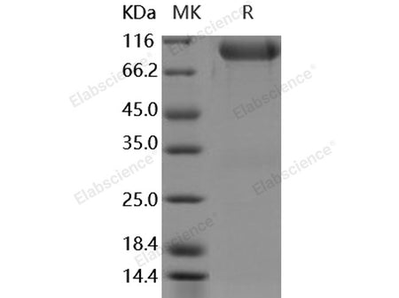 Recombinant Human FGFR3/CD333 Protein (alpha(IIIb), Fc Tag)