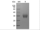 Recombinant Human Fibrillin-1/FBN1 Protein (His Tag)