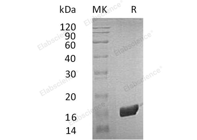 Recombinant Human FKBP2 Protein (His Tag)