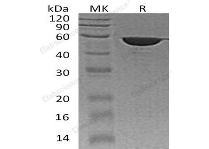 Recombinant Human FKBP4 Protein (His Tag)