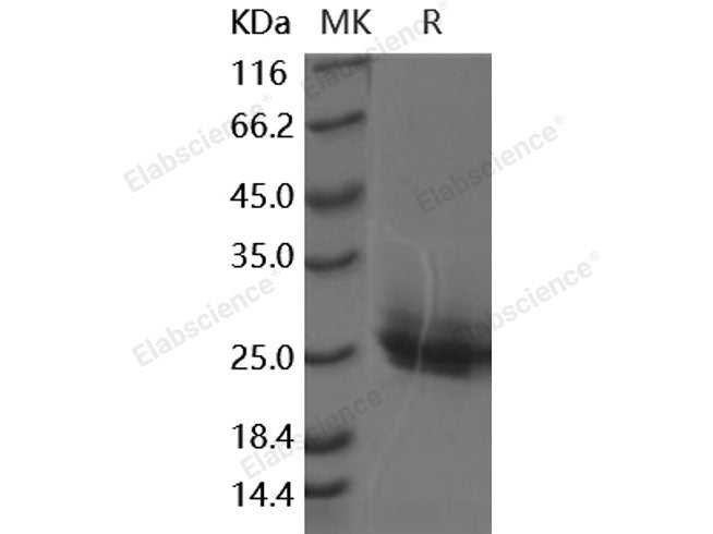 Recombinant Human Frizzled-10/FZD10 Protein (His Tag)
