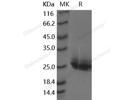 Recombinant Human Frizzled-10/FZD10 Protein (His Tag)