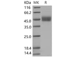 Recombinant Human FSTL1 Protein (His Tag)