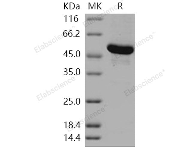 Recombinant Human GBA3/CBGL1 Protein (His Tag)(Active)