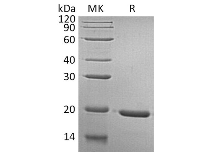 Gh1 Microsol Recombinant Human GH1/Growth hormone 1 Protein – MSE Supplies