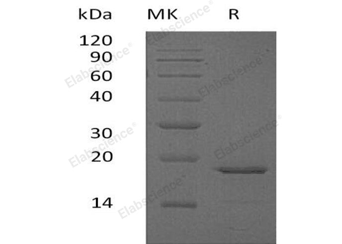 Recombinant Human Glucagon/GCG Protein (His Tag)