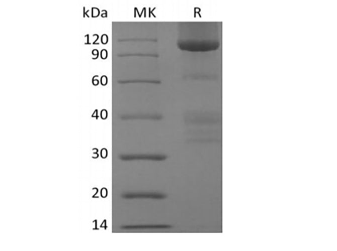 Recombinant Human Glypican-3/GPC3/OCI5 (C-Fc)