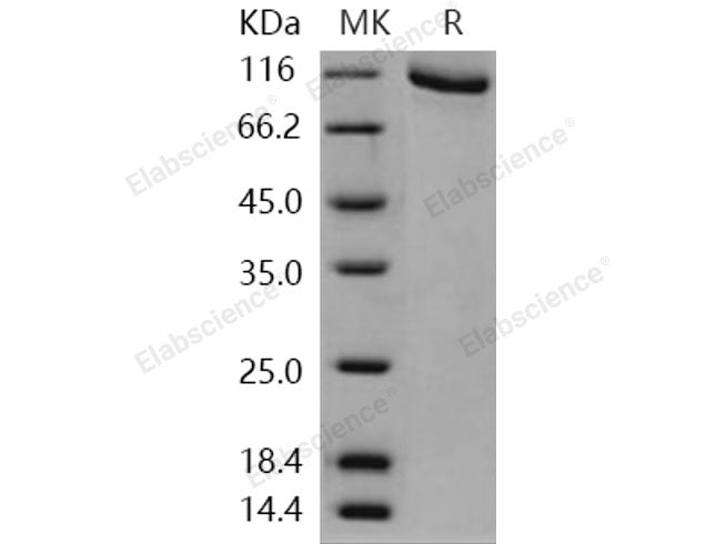 Recombinant Human GRK2/ADRBK1 Protein (His & GST Tag)