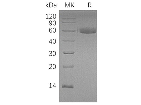 Recombinant Human HAO1 Protein (His Tag)