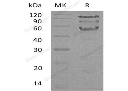 Recombinant Human HCLS1 Protein (His Tag)