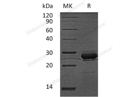 Recombinant Human Hepcidin/HAMP Protein (GST Tag)