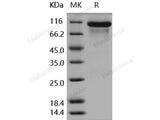 Recombinant Human HER3/ErbB3 Protein (His Tag)(Active)