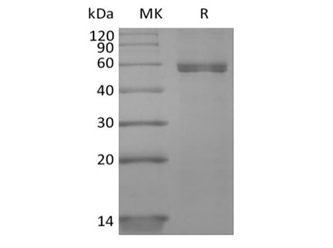 Recombinant Human HLA-A*0201 NY-ESO-1 complex Protein (C-10His)