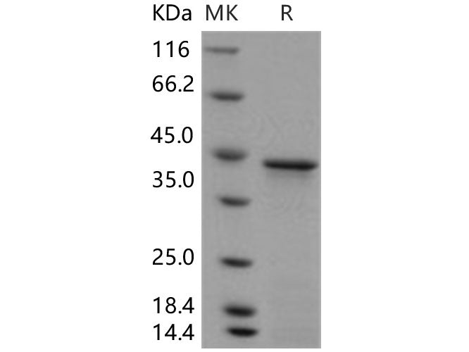 Recombinant Human HOXA1 Protein (His Tag)