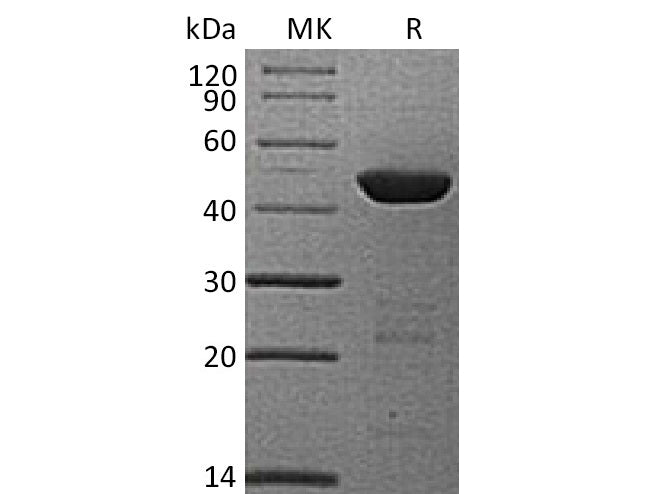 Recombinant Human HPD/4HPPD Protein (His Tag)