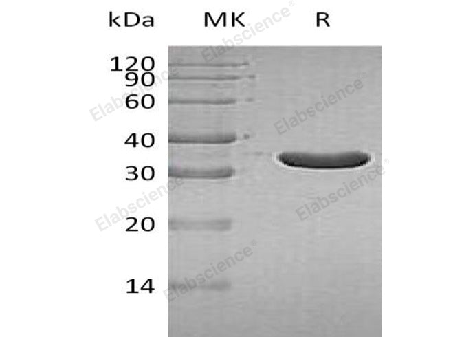 Recombinant Human IA2/PTPRN Protein (aa 687-979, His Tag)