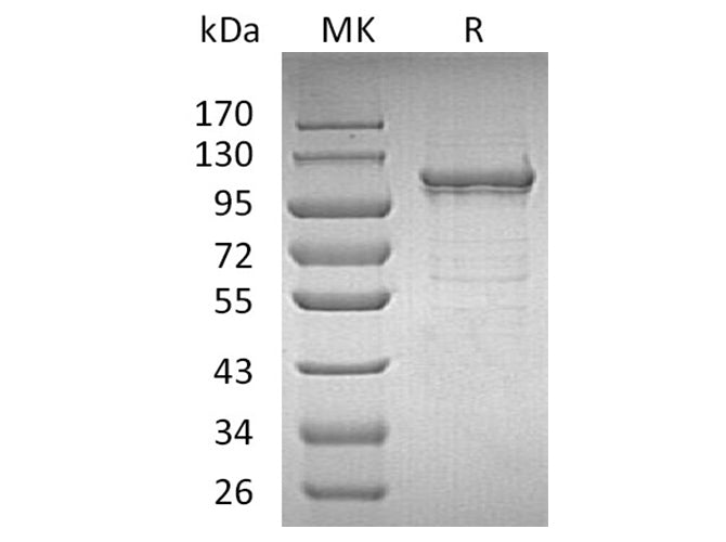 Recombinant Human IDE/Insulysin Protein (His Tag)