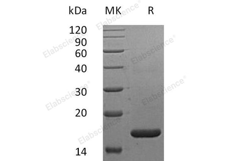 Recombinant Human IFNα2b/IFNA2 Protein (Lys46)