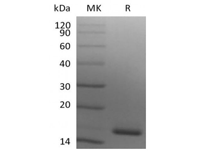 Recombinant Human Ig lambda constant 2 (C-6His)