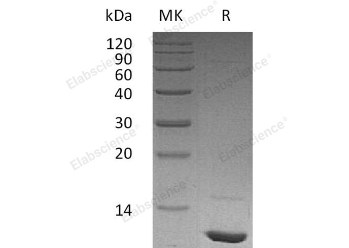 Recombinant Human IGF-1/IGF1 Protein (Active)