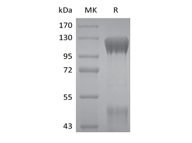 Recombinant Human IGF-I R/IGF1R (C-6His)