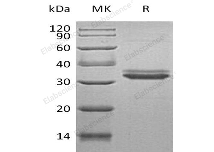 Recombinant Human IGFBP-4/IGFBP4 Protein (His Tag)