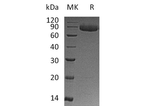 Recombinant Human IL-12 Receptor Subunit Beta1/IL-12RB1/CD212 (C-6His)