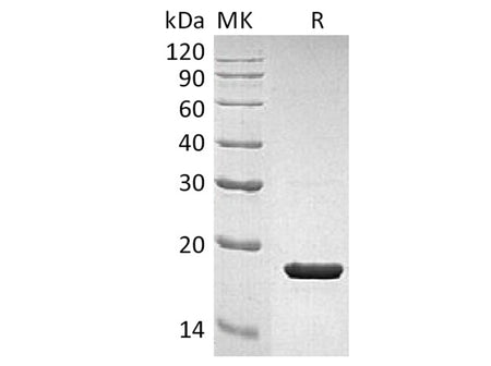 Recombinant Human IL-1RA/IL1RN Protein
