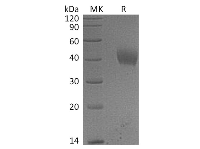 Recombinant Human IL-20RA/IL-20R1 Protein (His Tag)(Active)