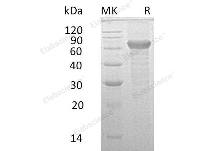 Recombinant Human IL-20RB Protein (Fc Tag)