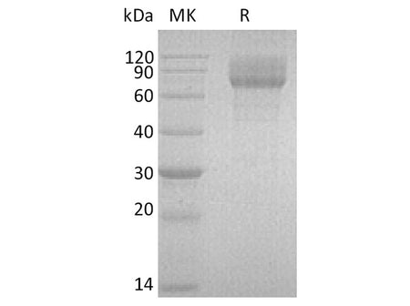 Recombinant Human IL-22BP/IL-22RA2 Protein (Fc Tag)