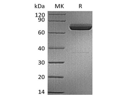Recombinant Human IL-23 alpha & Mouse IL-12 beta Heterodimer (C-6His) Purity >95%
