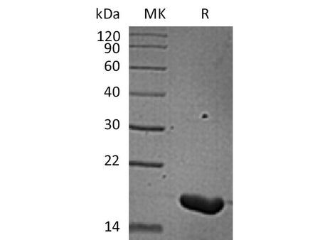 Recombinant Human IL-36 Beta/IL-1F8(157AA)