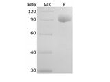 Recombinant Human IL-6RA (C-Fc)