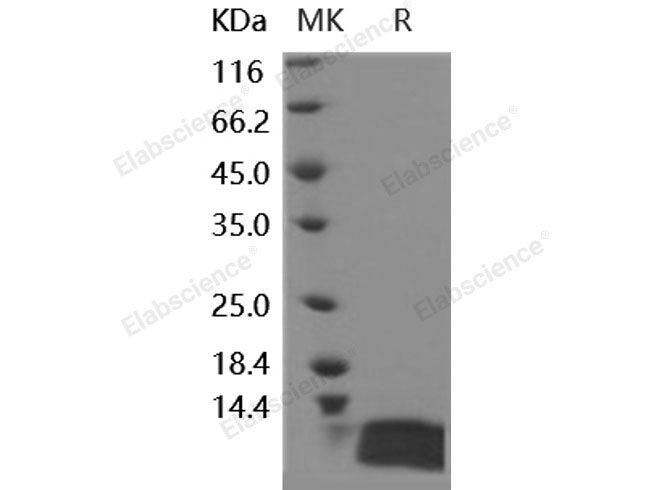 Recombinant Human IL-8/CXCL8 Protein (E.coli)
