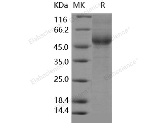 Recombinant Human IL13RA2/CD213A2 Protein (His Tag)(Active)