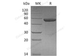Recombinant Human IL15RA&IL15 Fusion Protein (Fc Tag)(Active)