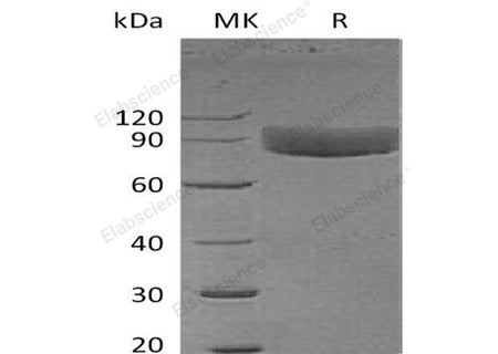 Recombinant Human IL1R1/CD121a Protein (Fc Tag)