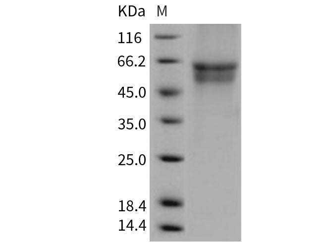 Recombinant Human IL3RA/CD123 Protein (His Tag)(Active)