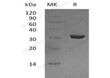 Recombinant Human IMPA2/IMPase 2 Protein (His Tag)