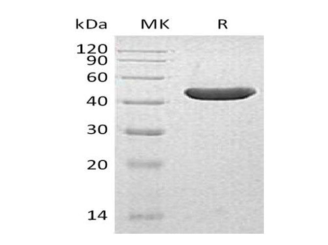 Recombinant Human INPP5A Protein (His Tag)