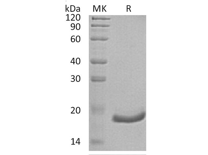 Recombinant Human Interferon α-6/IFNA6 Protein (His Tag)