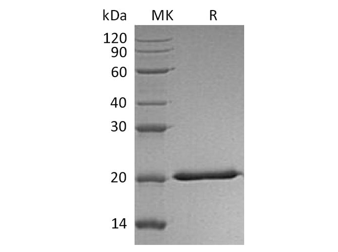 Recombinant Human Interferon Lambda-2/IL-28A Protein (His Tag) 