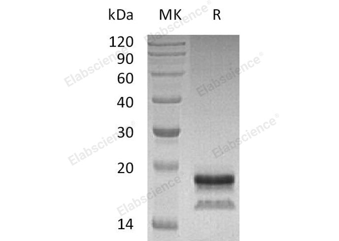 Recombinant Human Interleukin-17A/IL-17A Protein (Human Cells, His Tag)(Active)