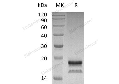 Recombinant Human Interleukin-17A/IL-17A Protein (Human Cells, His Tag)(Active)